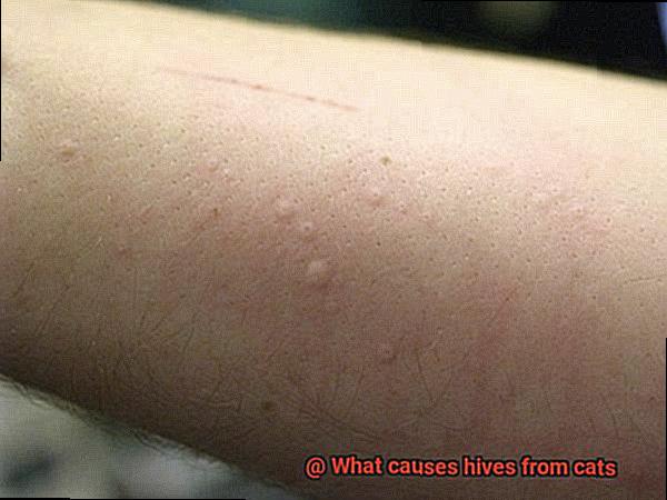 What causes hives from cats-7