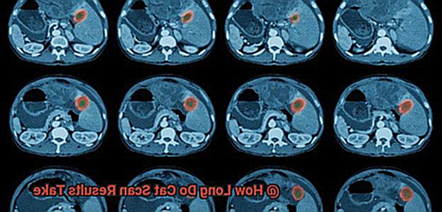 How Long Do Cat Scan Results Take-2